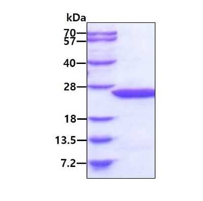 SDS-Page: Recombinant Human MDP1 His Protein [NBP1-50907] - 3ug by SDS-PAGE under reducing condition and visualized by coomassie blue stain